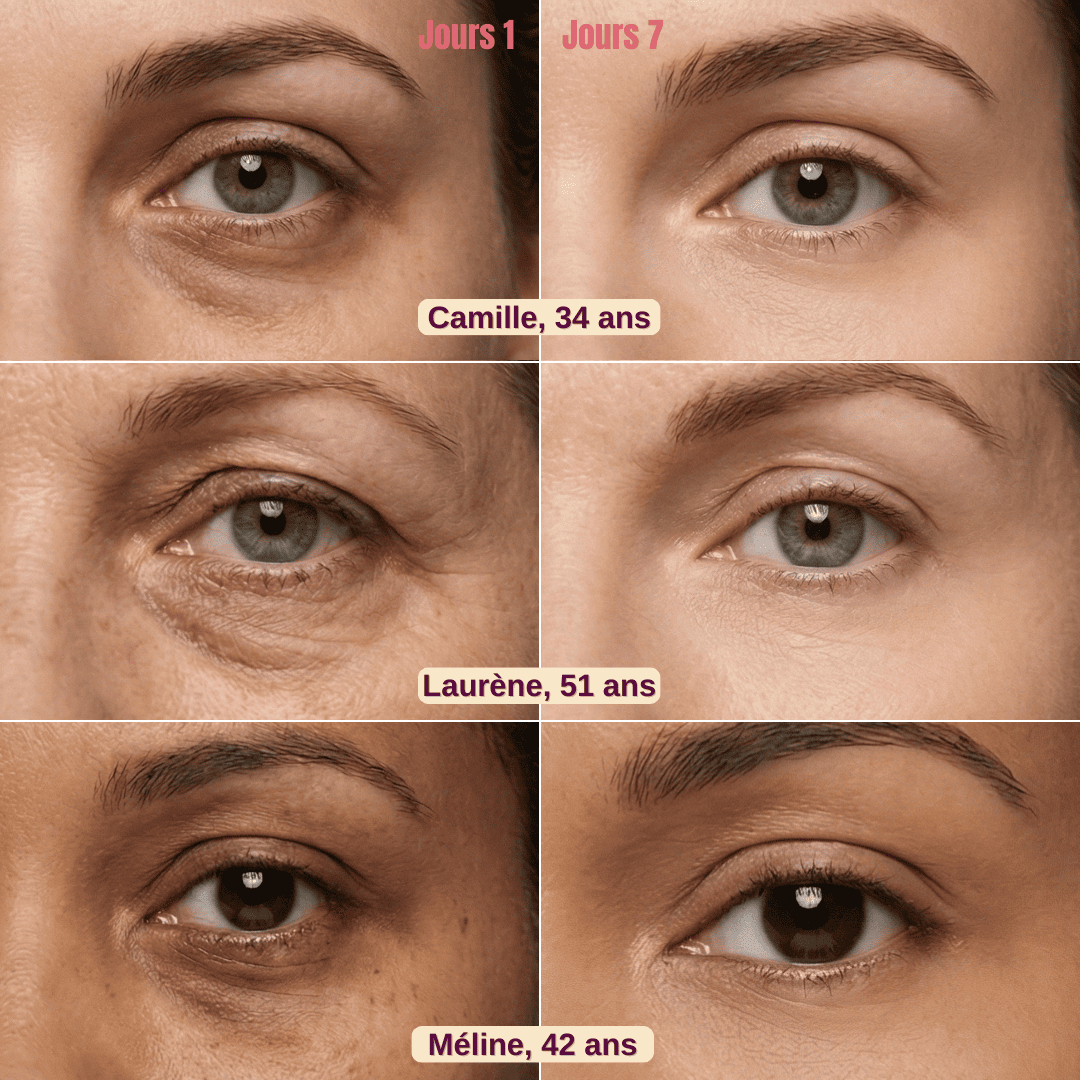 Patchs Anti-Cernes Nouvelle Génération Meara™